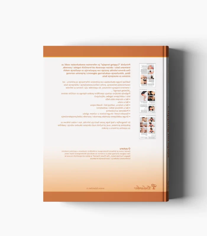 Cupping terapija - Slika 2